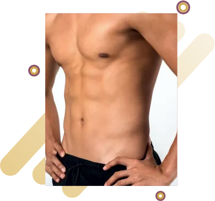 Abdominoplastia Masculina